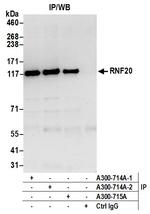 RNF20 Antibody in Immunoprecipitation (IP)