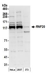 RNF20 Polyclonal Antibody