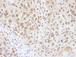 RNF20 Polyclonal Antibody