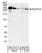 NUP214 Polyclonal Antibody
