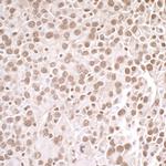 PRMT1 Polyclonal Antibody