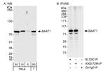 BAAT1 Antibody in Western Blot (WB)