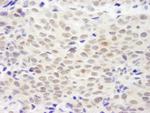 XLF Polyclonal Antibody