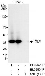 XLF Antibody in Immunoprecipitation (IP)