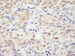 XLF Polyclonal Antibody
