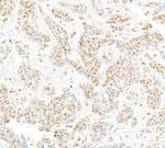Cul4a Polyclonal Antibody
