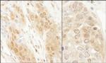 DJ-1 Polyclonal Antibody