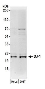 DJ-1 Antibody in Western Blot (WB)