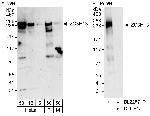 ZC3H13 Polyclonal Antibody