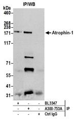 Atrophin 1 Antibody in Immunoprecipitation (IP)