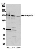 Atrophin 1 Polyclonal Antibody