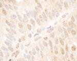 TCF12 Polyclonal Antibody