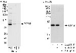 TCF12 Antibody in Western Blot (WB)