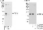 TCF12 Polyclonal Antibody