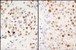 Phospho-MCM2 (Ser53) Antibody in Immunohistochemistry (Paraffin) (IHC (P))