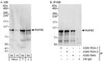 RAP80 Polyclonal Antibody