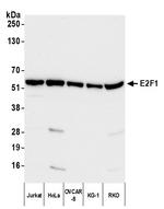 E2F1 Polyclonal Antibody