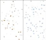 Phospho-KAP-1 (Ser824) Antibody in Immunocytochemistry (ICC/IF)