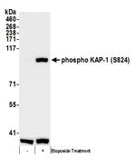 Phospho-KAP-1 (Ser824) Antibody in Western Blot (WB)