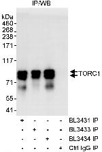TORC1 Polyclonal Antibody