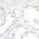 TORC1 Polyclonal Antibody