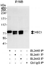HEC1 Polyclonal Antibody