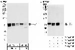HEC1 Polyclonal Antibody
