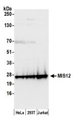 MIS12 Antibody in Western Blot (WB)