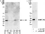 MED18 Antibody in Western Blot (WB)