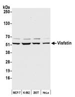 Visfatin Polyclonal Antibody