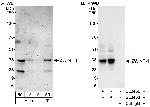 ZWINT-1 Antibody in Western Blot (WB)