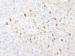 CDT1 Antibody in Immunohistochemistry (Paraffin) (IHC (P))