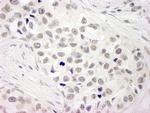 NCOA5/CIA Polyclonal Antibody