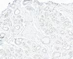 TRIP1/SUG1 Polyclonal Antibody