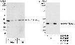 TRIP1/SUG1 Polyclonal Antibody