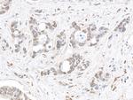 MED1 Polyclonal Antibody