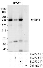 NIF1 Antibody in Immunoprecipitation (IP)