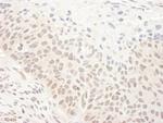 DHX33 Polyclonal Antibody