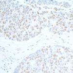 SUPT6H Polyclonal Antibody