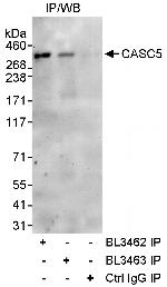 CASC5 Antibody in Immunoprecipitation (IP)