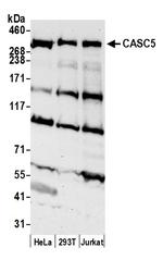 CASC5 Polyclonal Antibody