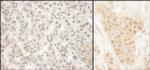 MCAK Antibody in Immunohistochemistry (Paraffin) (IHC (P))