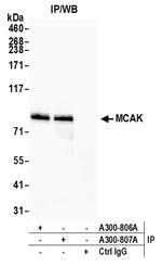 MCAK Antibody in Immunoprecipitation (IP)