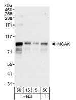 MCAK Antibody in Western Blot (WB)