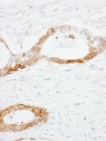 CRABP2 Antibody in Immunohistochemistry (Paraffin) (IHC (P))
