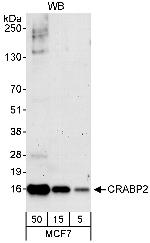 CRABP2 Antibody in Western Blot (WB)