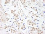 SAFB1 Polyclonal Antibody