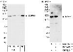 SAFB1 Antibody in Western Blot (WB)