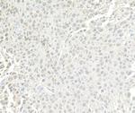 BRG1/SMARCA4 Polyclonal Antibody
