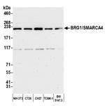 BRG1/SMARCA4 Antibody in Western Blot (WB)